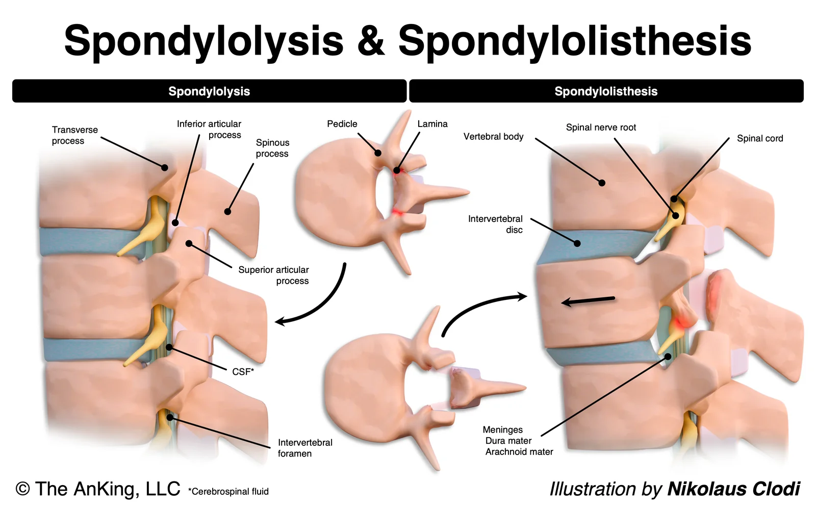 Medical Illustrations — example by Nikolaus Clodi